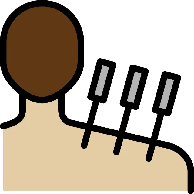 Acupuncture