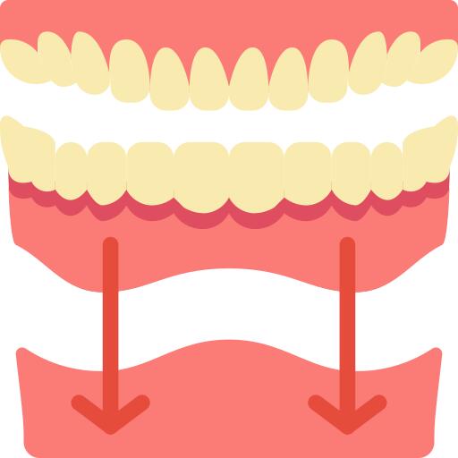 Dental implant
