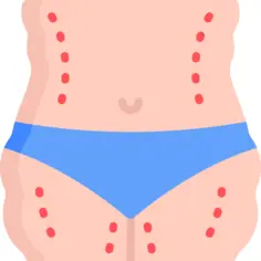 Liposuction