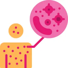 Smallpox