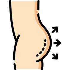Gluteus